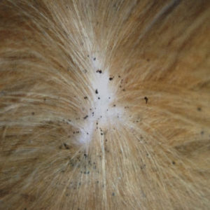 Flea Poop or Flea Dirt. How It Looks And How To Get Rid Of It. - Fleas ...